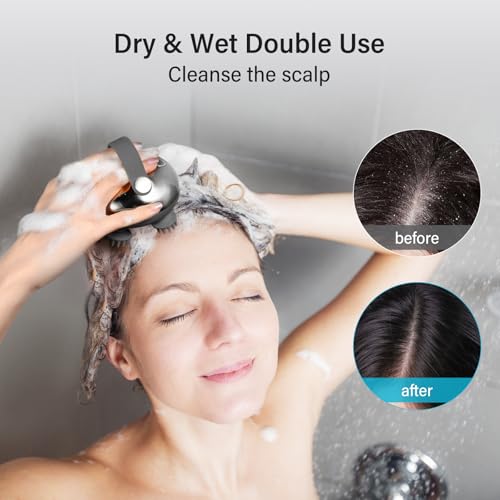 arboleaf Scalp Massager Electric Head Massage IPX7 Waterproof with 8 Removable Massage Heads and 3 Massage Modes, Handy Head Massager for Relaxation, Deep Cleaning (Silver)