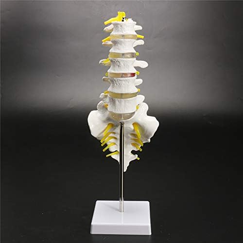 Anatomical Human Spine Model Consists of 5 Lumbar Vertebrae with Intervertebral Discs,Lumbar Nerves and Spinal Sacrum Coccyx With base