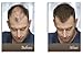 Rempli Keratin Instant Hair Fibers Beard Filler LARGE 25g (.88oz) 60 Day Supply (Black)