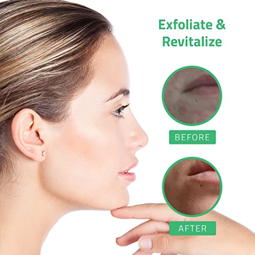 Glycolic Acid Peel for Face Professional 30 Gel with Retinol & Green