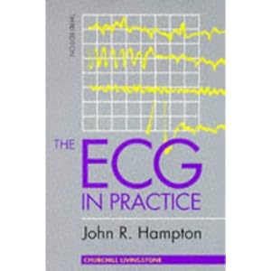The ECG in Practice, 3e