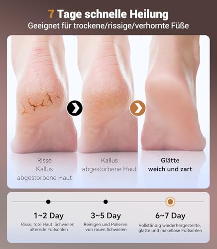 Electric Callus Remover, Exfoliating NO.1-99.98% Residue-Free, Electric Callus Remover, 130 g & Mini Format, Fatigue-Free, Rechargeable with Type-C, for Dead Hard Cracked Skin UU-MJQ