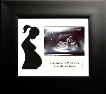 Babyrice Cadre Photo Fait Main Avec Passe Partout Pour Echographie De Bebe Noir Blanc Amazon Fr Bebes Puericulture