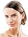 Tatuo 2 Pairs Acrylic Mottled Earrings Bohemian Statement Earrings Resin Drop Dangle Ear Jewelry for Women Valentine's Day Presents