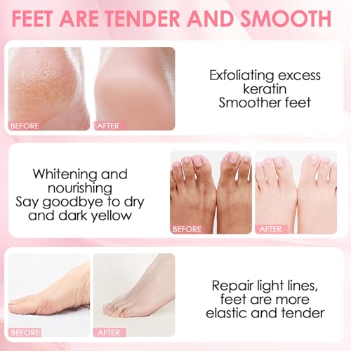 2 Pairs Exfoliating Peeling Foot Mask, Soft Exfoliating Action, Heels and Dry Dead Skin for Soft Feet, Long Moisturizing, Moisturizing Foot Mask (Pink/Aloe)
