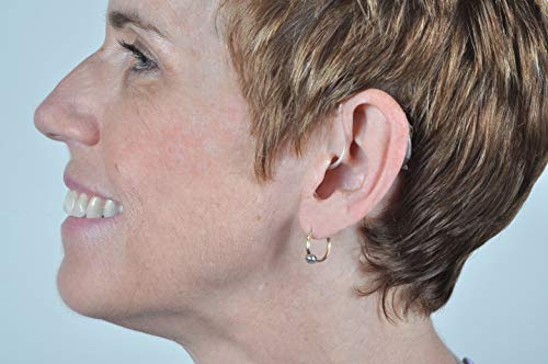 ZVOX VoiceBud VB20 Hearing Amplifier with Two-Microphone NoiseBlocker Technology, App Control (Champagne Left) - Thumbnail 3