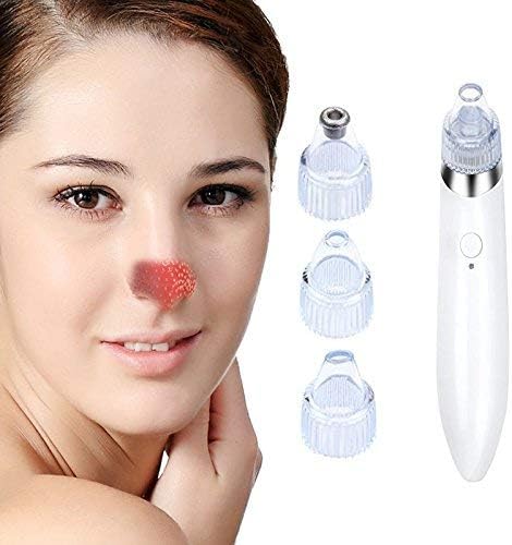 【New Version 2018】Chuangma Blackhead Remover Tool Pore Vacuum Comedone Extractor Acne Comedo Suction Microdermabrasion Exfoliating Machine Rechargeable White Set