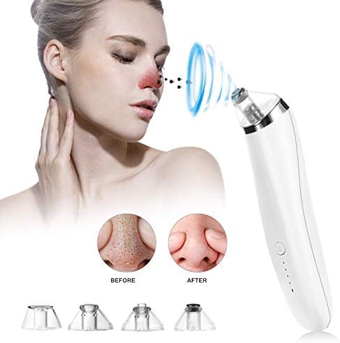 Blackhead Remover Pore Vacuum - Electric Blackhead Vacuum Cleaner Blackhead Extractor Tool Device Comedo Removal Suction Beauty Device for Facial Skin Treatment By Mespirit