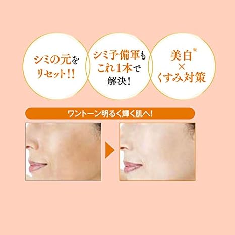 Amazon 医薬部外品 ヴァーナル クリアホワイトニング 90ｍl 美白化粧水 化粧水 シミ くすみ そばかす ケア B アルブチン シャクヤクエキス 配合 ヴァーナル 美容液 通販