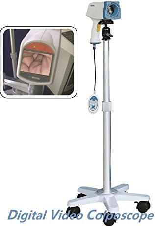 Kernel Gynecology Instrument Video Colposcope Digital Colposcopy for laptop desktop