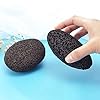 2PCS-Foot-Scrubber-Stone-Natural-Pummice-Stones-Callus-Foot-Scrubber-Hard-Skin-Remover-Foot-Stone-with-Dry-Bath-Brush-for-Hands-Body-Foot-Dead-Hard-Skin 2PCS Foot Scrubber Stone, Natural Pummice Stones Callus Foot Scrubber Hard Skin Remover Foot Stone with Dry Bath Brush…