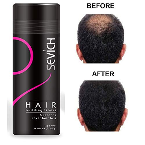 Economy Keratin Hair Building Fibers Instantly Thickens Thinning or Balding Hair for Men and Women - Natural Hair Loss Concealer 0.87oz (Medium Brown) - Thumbnail 5