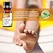 Plantar Wart Remover, Wart Removal, Salicylic Acid Wart Removal, Maximum Strength, Painlessly Remove Plantar Warts, Stops Wart Regrowth, 10ml