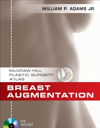BREAST AUGMENTATION: AN OPERATIVE ATLAS