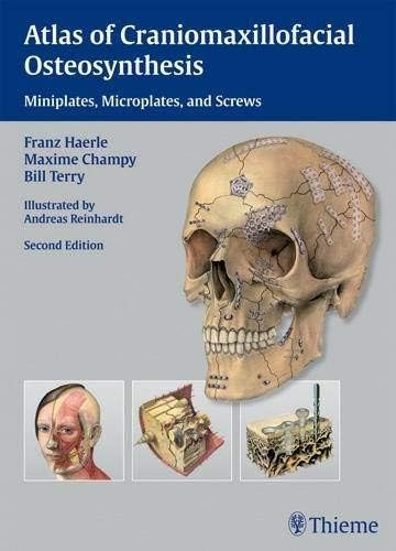 Atlas of Craniomaxillofacial Osteosynthesis: Microplates, Miniplates, and Screws Hardcover – 25 Feb. 2009