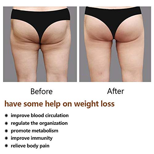 Wskderliner Suction Cup for Cellulite Slimming Vacuum Massage Cupping Anti-cellulite Silicone White Transparent Pack of 4