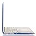 MOSISO Plastic Hard Shell Case & Keyboard Cover Skin & Screen Protector Only Compatible with MacBook Air 11 inch (Models: A1370 & A1465), Royal Blue