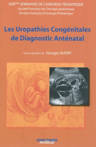 Les  uropathies congénitales de diagnostic anténatal