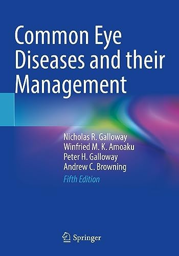Glaucoma: 2-Volume Set: 9780702051937: Medicine & Health Science