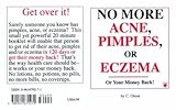 No More Acne, Pimples, or Eczema by 