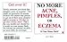 No More Acne, Pimples, or Eczema by 