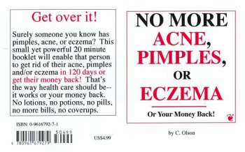 No More Acne, Pimples, or Eczema by C. Olson (Paperback)