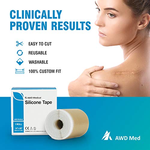AWD Medical Grade Soft Silicone Gel Tape for Scar Removal (1.6” x 60