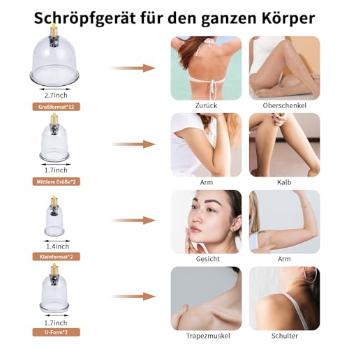 Cupping Glasses with Vacuum Pump & Therapy Magnets + Fascia Scraper, Cupping (18 Pieces) Against Tension & Cellulite and Lymphatic Drainage, High-Quality Cupping Glass Set for Face and Body