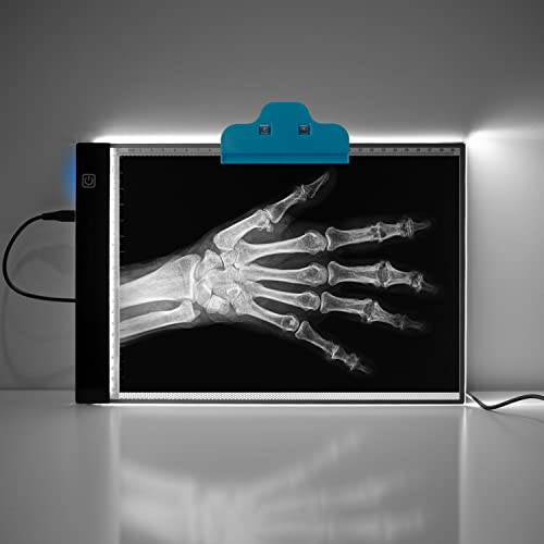 Poit A4 LED Light Mat Tracing Copier Tablet Lamp Box with Dimmable Brightness for Artist Drawing Drawing Anime Template and X-Ray Watching