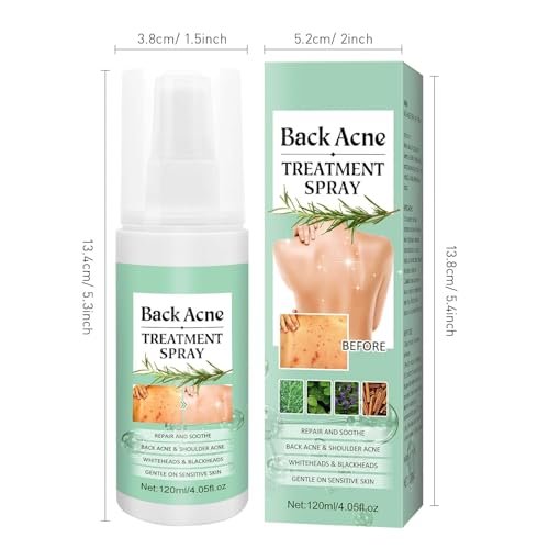 LBOYLOVE® Back Acne Treatment Spray – 2% Salicylic Acid & Hypochlorous Acid Spray for Body Acne, 120ml – Deep Cleansing, Fades Scars, Soothing Repair for Back, Chest & Shoulders