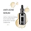 IMIM-Acne-Treatments-Serum-Double-Strength-Spot-Blemishes-Blackheads-Removal-Treatment-Suitable-for-Prone-to-Acne-Face-Serum-for-All-Skin-Types IMIM Acne Treatments Serum Double Strength Spot Blemishes Blackheads Removal Treatment Suitable for Prone to Acne Face…