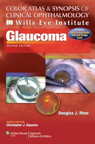 Download Glaucoma PDF