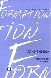 Les  cancers osseux