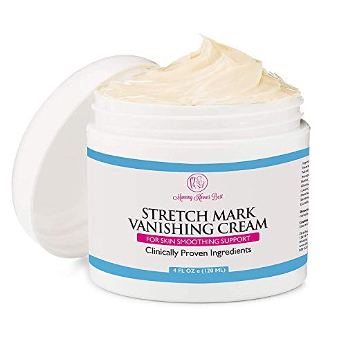 4 Stretch+Mark+Cream+Pregnancy+Alternative