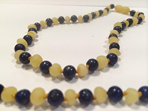 Raw Unpolished 17 inch ADHD & anti-inflammatory; arthritis, carpal tunnel Milk Baltic Amber Necklace with Lapis Lazuli (for stress, anxiety, ADHD) for children, big kids, woman, man, girl, boy, adult (Unisex) (Large beads Milk White Butter Yellow Blue) - Unolished Amber and Polished Lapis, Anti Flammatory, Pain Reduce Reduction Properties - Natural Certificated Oval Baroque Round Baltic Jewelry with the Highest Quality Guaranteed. Easy to Fastens with a Twist-in Screw Clasp Mothers Approved Remedies! Helps some with stress, anxiety, insomnia, headache, carpal tunnel, arthritis, and more. (Raw Milk Lapis Lazuli)