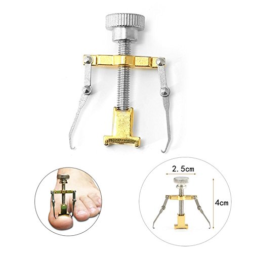 Ingrown Toenail Correction Tools Paronychia Toe Nail Corrector Recover