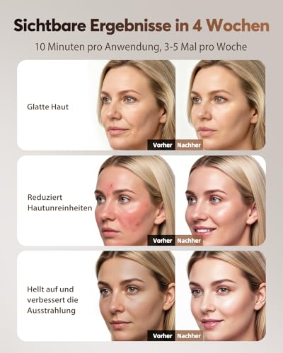 XSSNVV LED Face Mask, Wireless Light Therapy Face Mask, 4 Modes for Anti-Ageing, Skin Clarification, Anti-Inflammatory, Soothing, Red/Blue LED, Rechargeable Red Light Lamp Face, Beauty Gifts