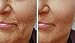 Bee Youth-full Rejuvenating Anti Aging Serum - Face Oil - Reduce Wrinkles Fine-Lines - Age Spot Remover for Face - USDA Approved - Organic - Vegan - Cruelty-Free - Non-GMO - Paraben-Free