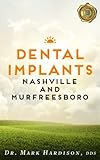 Dental Implants Nashville and Murfreesboro (The Doctor Author Expert Book Series 2)