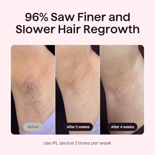 Wavytalk IPL Hair Removal Device for Men and Women, 24J Dual Pulse Technology & Ice Cooling System, Painless IPL Hair Removal Device for Face, Bikini, Body, with Razor and Cable Connection