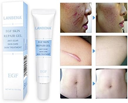 Mismoxy LANBENA EGF Scar Repair Gel,Removal,Acne Scar Removal,Scar Gel,Scar Treatment Cream,Scar Fade Cream for Face and Body