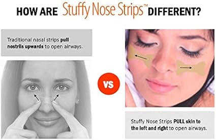 Amazon Com Nasal Strips Stuffy Nose Strips Go On Cheeks Not Over Noses Instant Relief For Allergies Colds Flu Sinus Issues And Snoring Pulls Open Airways By Over 61 Vs 30