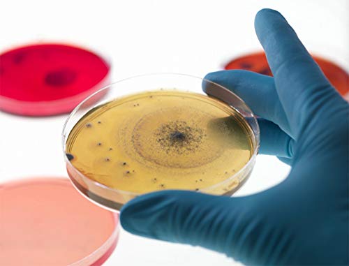 Onnetila Bacteria Science Kit Petri Dishes with Agar Educational STEM Science Fair Project Kit for Kids Age 9 and Above
