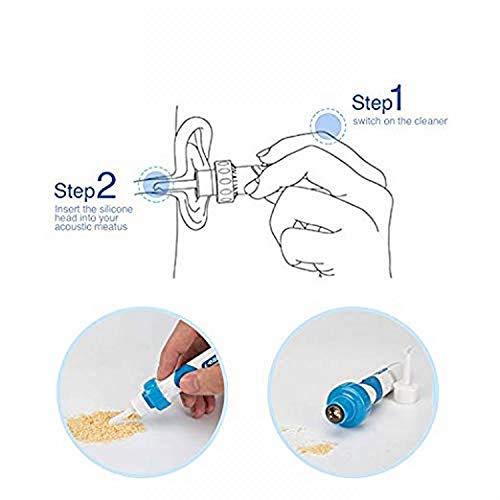 Portable Automatic Electric Vacuum Ear Wax Earwax Removal Tool Kit, Ear Vacuum Cleaner Easy Earwax Remover Soft Prevent Ear-Pick Clean Tools Set for Adults Kids