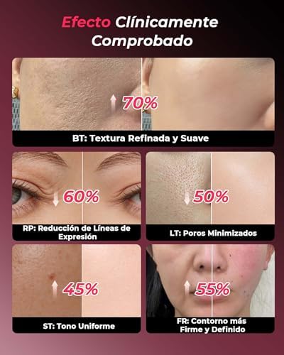 Dispositivo Profissional de Radiofrequência Facial, Massajador Facial Microcorrente 5 em 1, Dispositivo Elétrico Anti-acne, Anti-rugas, Firmamento e Lifting para Rosto e Pescoço (Rose Gold)