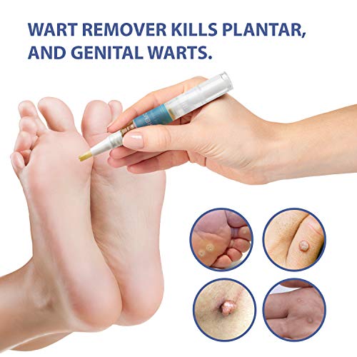 ST. Mege Wart Pen - Maximum Strength - Wart Pen for Flat Warts, Plantar Warts, Common Warts - Corn, Callus - Lightweight - Easy-to-Use - Travel-Friendly