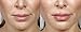 WUNDERKISS - Lip Plumping Gloss with Plumping Booster