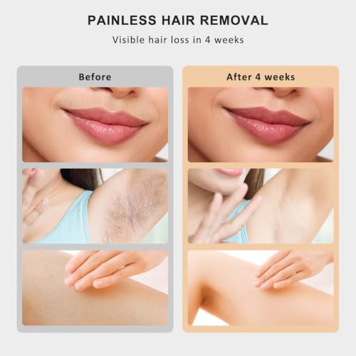 NALONE Depiladora Laser IPL, 4 en 1 Depiladora Luz Pulsada - HR/SC/RA/BT, 10 Potencias, para Mujeres y Hombres, Uso en Casa, Rostro, Cuerpo y Axilas
