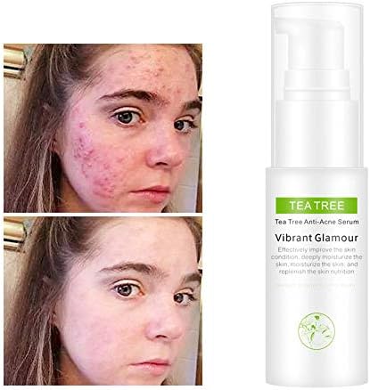 Tea Tree Toner, Repair Acne Print Shrink Pores Refreshing Moisturizing Oil Control Brighten Skin Tone