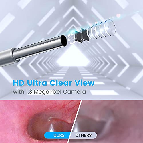 Anykit USB Otoscope for PC & Android Device(NOT for iPhone/iPad), Ultra